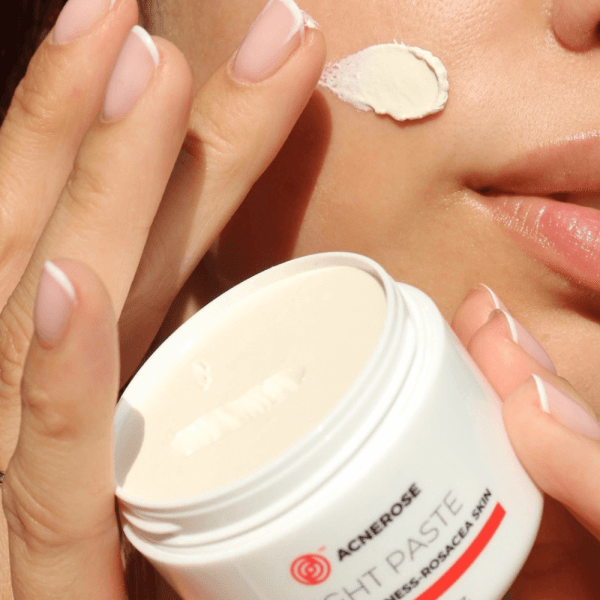 Acnerose - pasta na noc, konsystencja na skórze Acnerose - pasta na noc, konsystencja na skórze